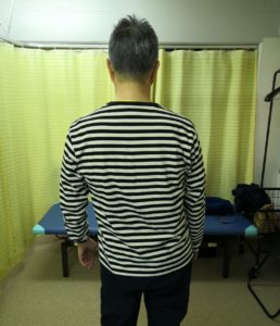 腰痛患者