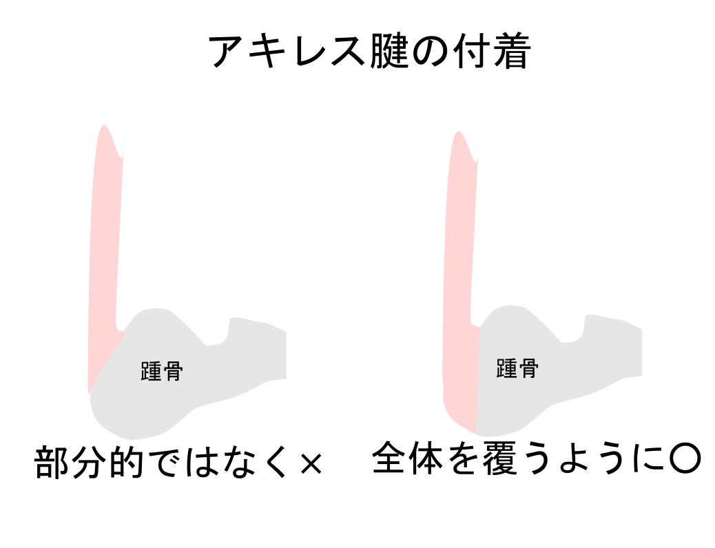 アキレス腱付着部構造