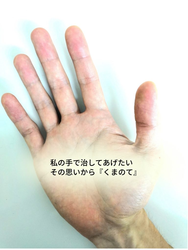 くまのて接骨院の院長の手で坐骨神経痛も改善に導く