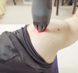 近赤外線照射肩