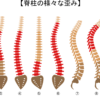 脊柱の歪み