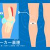 ベーカー嚢腫は膝の裏に袋が出来る疾患