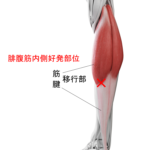 腓腹筋内側肉離れ好発部位