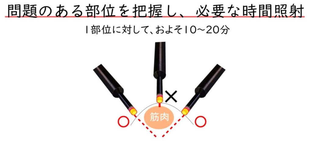 メディチャーライトの照射イメージ。筋肉内に光が浸透し、様々な角度から施術を行うことで弾力性が向上する様子を示しています。