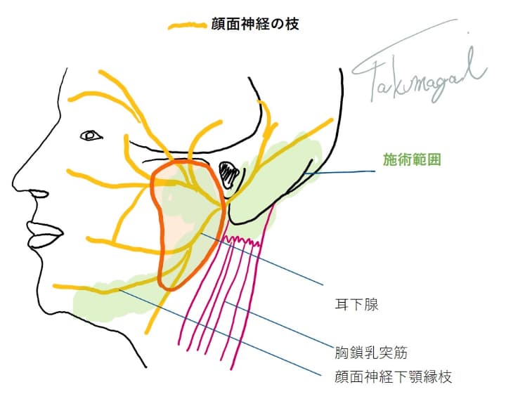 くまのて接骨院院長イラスト転載禁止ネッター参照耳下腺に顔面神経が貫通するイラスト