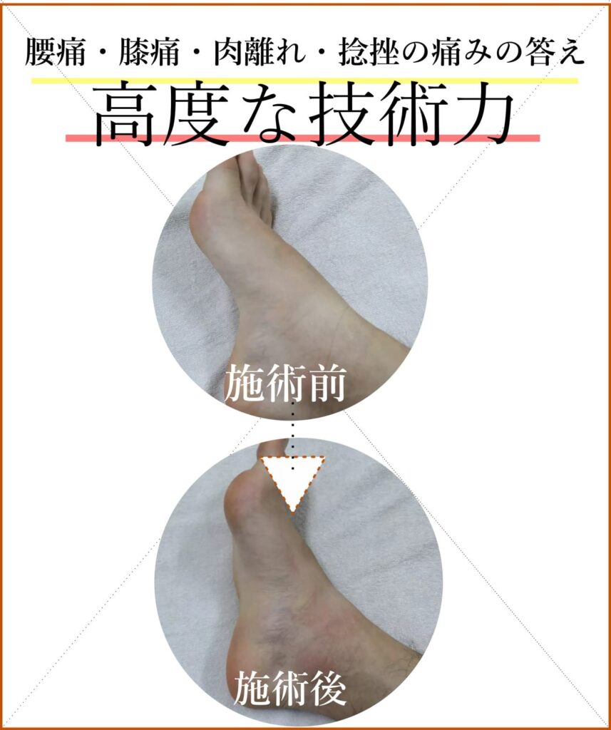 高度な技術力捻挫の答えビフォーアフター画像