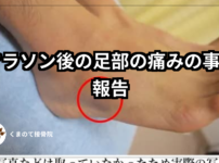 マラソン後の痛みに腓腹神経痛などの症例