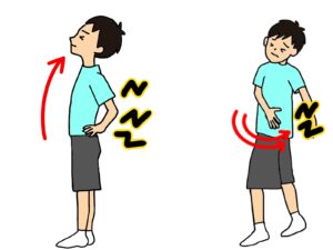 腰椎分離症イラスト
