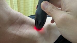 頸部の調整を近赤外線照射を行っている写真