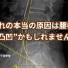 肉離れの本当の原因は腰椎の凸凹かもしれません。