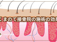 捻挫の腫れのアイキャッチ画像