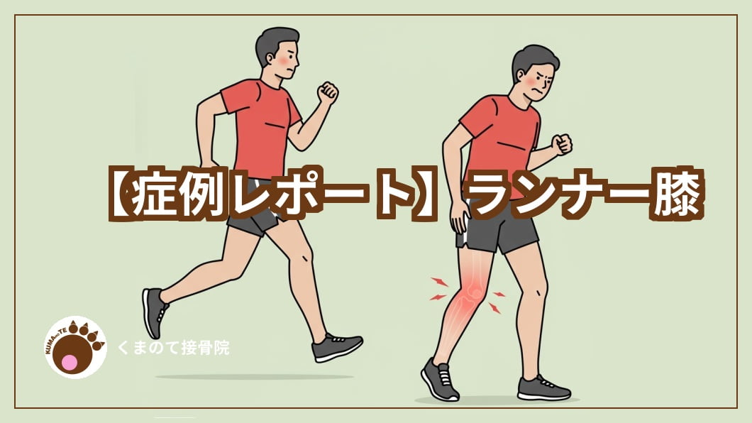 ランナーの画像と症例レポートのテキストアイキャッチ画像