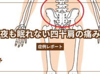 夜も眠れない四十肩の痛み