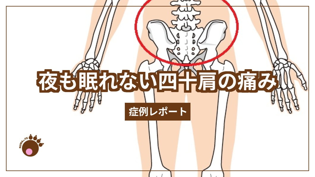 夜も眠れない四十肩の痛み