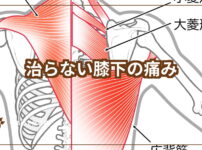 治らない膝下の痛み