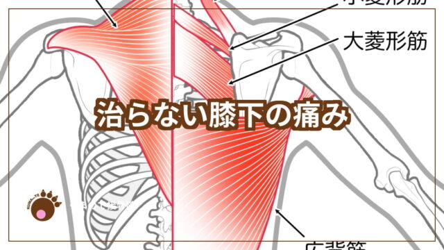 治らない膝下の痛み