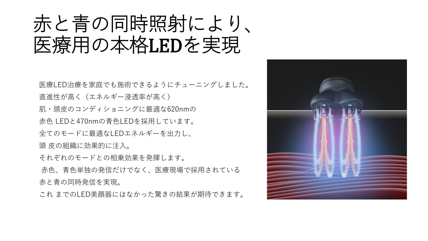 パーフェクトブライト詳細