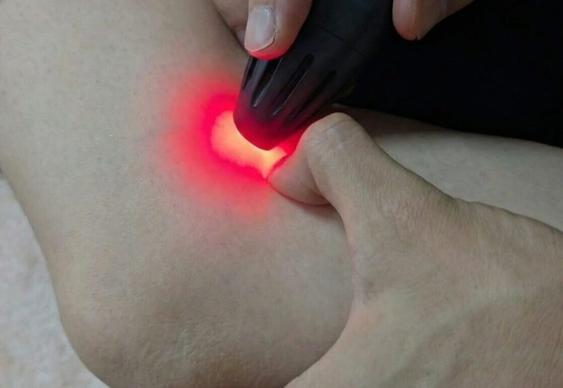 くまのて式 膝の根本治療